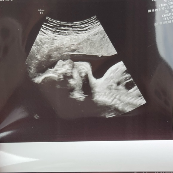 Meet your Posher, Nidia - Picture 15 of 16